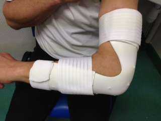 Port d'une attelle au coude