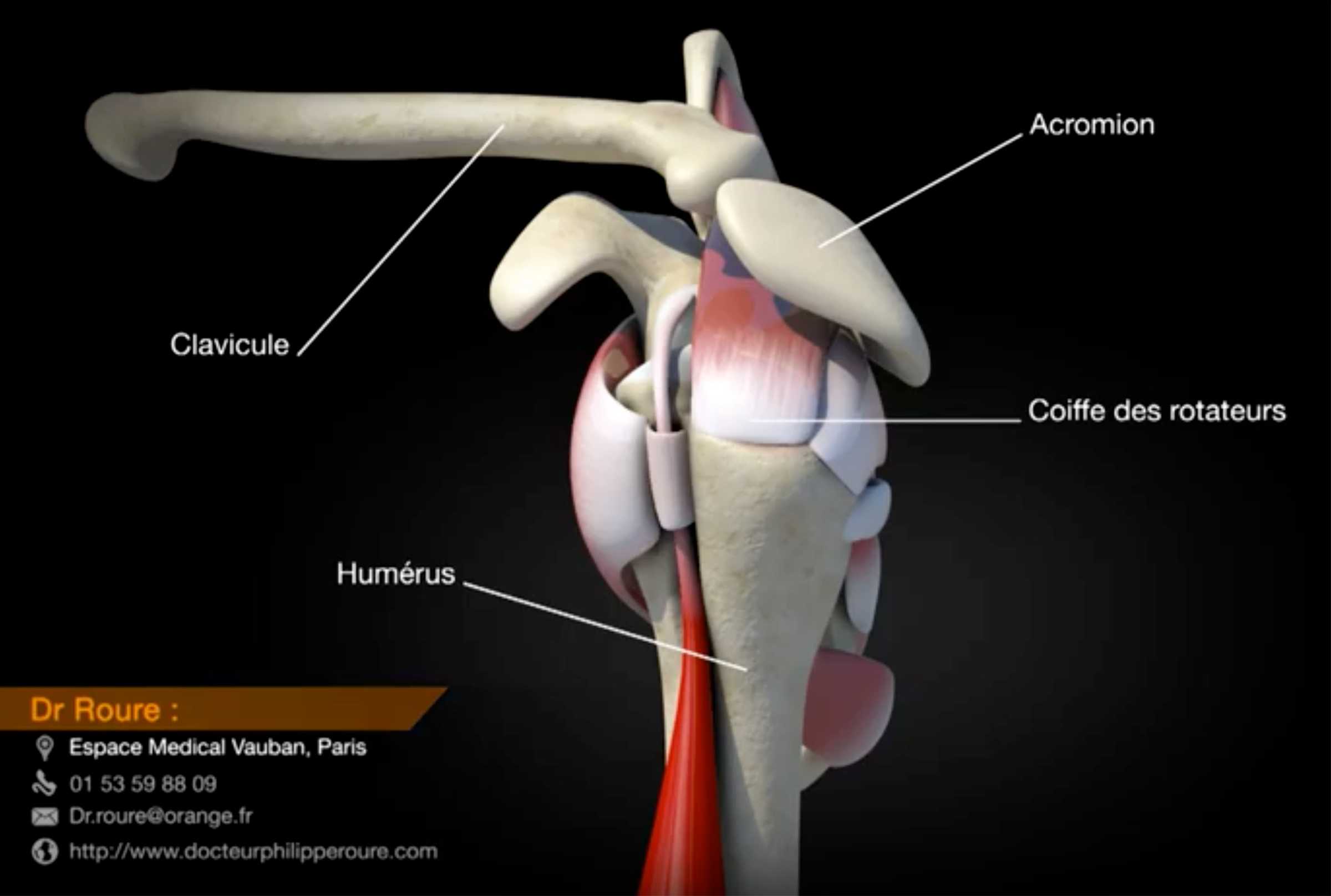 Tendinopathie de la coiffe des rotateurs Dr Roure