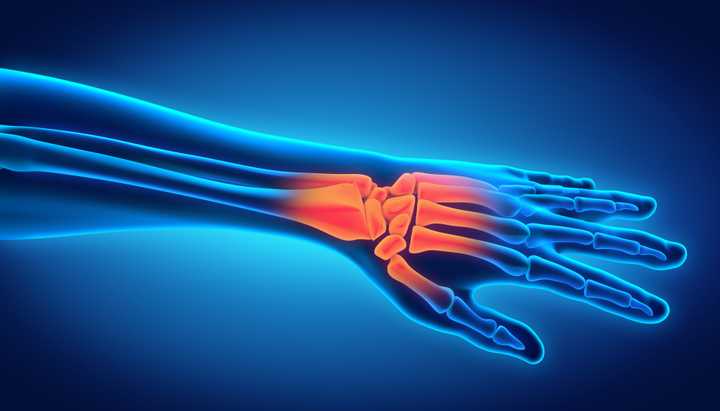 Carpal tunnel syndrome: diagnosis and surgery in Paris
